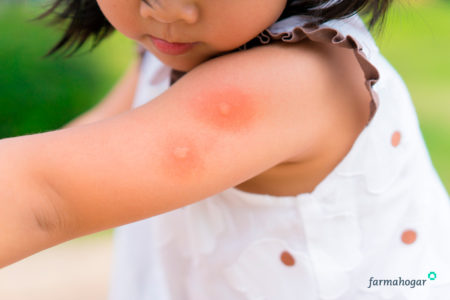 ¿Cómo combatir la alergia primaveral?